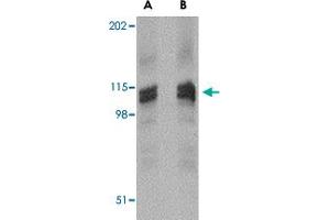 Western blot analysis of DLGAP3 in rat brain tissue lysate with DLGAP3 polyclonal antibody  at (A) 1 (B) 2 ug/mL . (DLGAP3 anticorps  (C-Term))