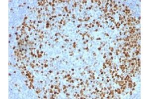 IHC testing of FFPE human tonsil with TOP2A antibody (clone TOP2A/1362). (Topoisomerase II alpha anticorps  (AA 1352-1493))