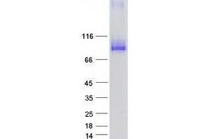Validation with Western Blot
