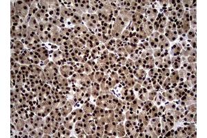 Image no. 5 for anti-Nibrin (NBN) (AA 183-460) antibody (ABIN1491058)