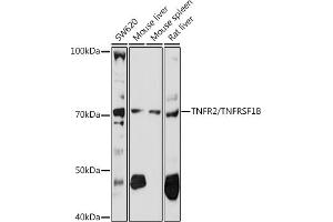 Western blot analysis of extracts of various cell lines, using TNFR2/TNFRSF1B antibody (ABIN3021423, ABIN3021424, ABIN3021425 and ABIN6215025) at 1:1000 dilution.