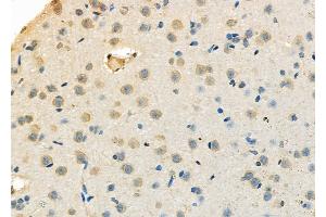 ABIN6263506 and ABIN6273143 at 1/100 staining Rat brain tissue by IHC-P.