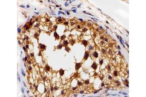 Immunohistochemical analysis of paraffin-embedded human testis section using VEGFR3 antibody at 1:25 dilution.