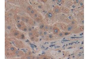 Detection of HPR in Human Liver Tissue using Polyclonal Antibody to Haptoglobin Related Protein (HPR)