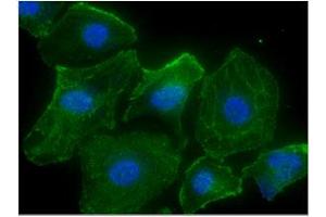 ICC/IF analysis of CASQ2 in HeLa cells line, stained with DAPI (Blue) for nucleus staining and monoclonal anti-human CASQ2 antibody (1:100) with goat anti-mouse IgG-Alexa fluor 488 conjugate (Green). (CASQ2 anticorps)