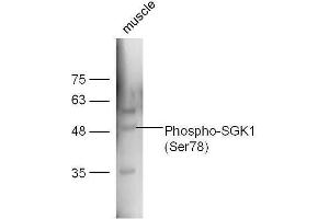 Mouse muscle lysates probed with Rabbit Anti-SGK1 (Ser78) Polyclonal Antibody, Unconjugated  at 1:5000 for 90 min at 37˚C. (SGK1 anticorps  (pSer78))