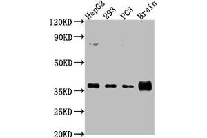 Western Blot Positive WB detected in: HepG2 whole cell lysate, 293 whole cell lysate, PC3 whole cell lysate, Rat brain tissue All lanes: RFNG antibody at 1:2000 Secondary Goat polyclonal to rabbit IgG at 1/50000 dilution Predicted band size: 37 kDa Observed band size: 37 kDa (RFNG anticorps  (AA 71-331))