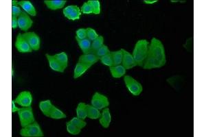 Immunofluorescence staining of Hela cells with ABIN7157400 at 1:100, counter-stained with DAPI. (Keratin 2 anticorps  (AA 207-424))