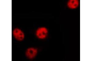 ABIN6267424 staining HeLa by IF/ICC.