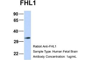 Host: Rabbit Target Name: FHL1 Sample Type: Human Fetal Brain Antibody Dilution: 1.
