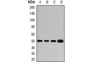 Western blot analysis of Ataxin 3 expression in Jurkat (A), A549 (B), mouse brain (C), mouse liver (D) whole cell lysates. (Ataxin 3 anticorps)