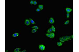 Immunofluorescent analysis of HepG2 cells using ABIN7172305 at dilution of 1:100 and Alexa Fluor 488-congugated AffiniPure Goat Anti-Rabbit IgG(H+L)