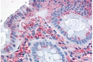 Human Colon: Formalin-Fixed, Paraffin-Embedded (FFPE)