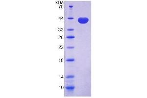 SDS-PAGE analysis of Mouse CDH5 Protein. (Cadherin 5 Protein (CDH5))
