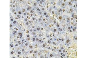 Immunohistochemistry of paraffin-embedded Rat liver using PSMC3 Polyclonal Antibody at dilution of 1:100 (40x lens). (PSMC3 anticorps)