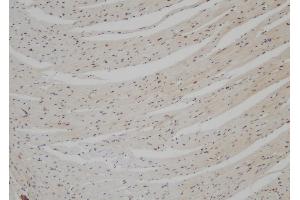 ABIN6275541 at 1/100 staining Mouse heart tissue by IHC-P. (TNNI3K anticorps  (Internal Region))