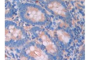 anti-Lecithin-Cholesterol Acyltransferase (LCAT) (AA 41-210) antibody