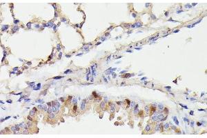 Immunohistochemistry of paraffin-embedded Mouse lung using CDC23 Polyclonal Antibody at dilution of 1:100 (40x lens). (CDC23 anticorps)