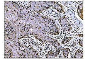 IHC analysis of JAB1 using anti-JAB1 antibody (ABIN7602482). (COPS5 anticorps  (AA 8-334))