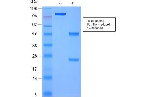 SDS-PAGE Analysis Purified Moesin Mouse Recombinant Monoclonal Antibody (rMSN/492).