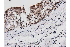 Immunohistochemical staining of paraffin-embedded Human liver tissue using anti-PEPD mouse monoclonal antibody. (PEPD anticorps)
