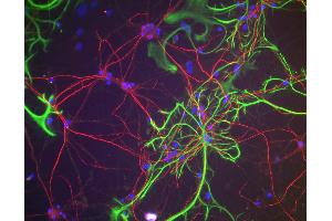 Immunofluorescence of rat cortical neurons and glia showing NF-H staining (red). (NEFH anticorps)