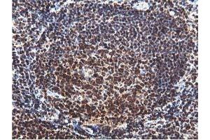 Image no. 3 for anti-RuvB-Like 2 (E. Coli) (RUVBL2) (AA 113-370) antibody (ABIN1490850) (RUVBL2 anticorps  (AA 113-370))