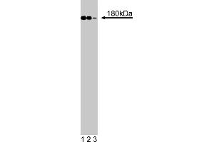 Western Blotting (WB) image for anti-Insulin Receptor Substrate 1 (IRS1) (AA 1131-1234) antibody (ABIN968515)