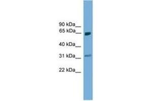 Image no. 1 for anti-Protein Inhibitor of Activated STAT, 2 (PIAS2) (AA 81-130) antibody (ABIN6744670) (PIAS2 anticorps  (AA 81-130))
