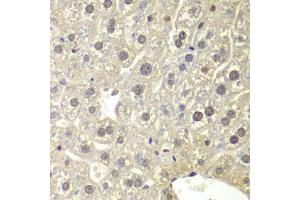 Immunohistochemistry (IHC) image for anti-Nuclear Receptor Subfamily 3, Group C, Member 1 (Glucocorticoid Receptor) (NR3C1) (AA 1-280) antibody (ABIN3023091)