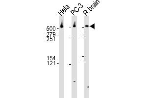 Western blot analysis of lysates from Hela, PC-3 cell line and rat brain tissue lysate(from left to right), using DYNC1H1 Antibody (C-term) (ABIN6242986 and ABIN6577559).