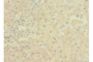 Immunohistochemistry of paraffin-embedded human liver tissue using ABIN7158162 at dilution of 1:100 (LRRC31 anticorps  (AA 1-300))