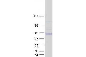 tyrosylprotein Sulfotransferase 2 (TPST2) (Transcript Variant 1) protein (Myc-DYKDDDDK Tag)