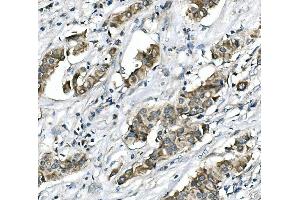 IHC analysis of RICTOR using anti-RICTOR antibody (ABIN7600744). (RICTOR anticorps  (AA 23-264))