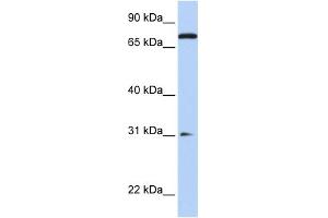 WB Suggested Anti-MAP4K1 Antibody Titration:  0. (MAP4K1 anticorps  (N-Term))