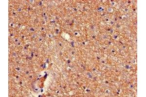Immunohistochemistry of paraffin-embedded human brain tissue using ABIN7168341 at dilution of 1:100 (RBM38 anticorps  (AA 1-239))