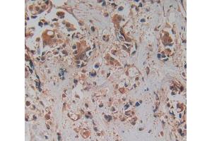 Used in DAB staining on fromalin fixed paraffin- embedded breast cancer tissue (PRCP anticorps  (AA 108-376))
