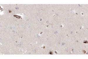 ABIN6272940 at 1/100 staining Human brain cancer tissue by IHC-P. (CISD2 anticorps  (Internal Region))