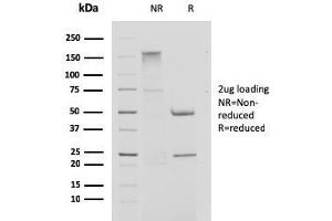 SDS-PAGE Analysis Purified Cystatin A Mouse Monoclonal Antibody (CPTC-CSTA-1).