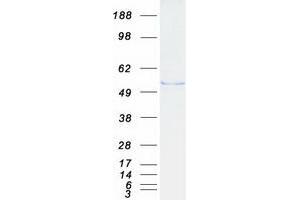 Validation with Western Blot