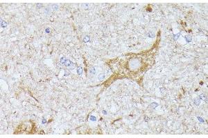Immunohistochemistry of paraffin-embedded Mouse spinal cord using TBCA Polyclonal Antibody at dilution of 1:100 (40x lens). (TBCA anticorps)