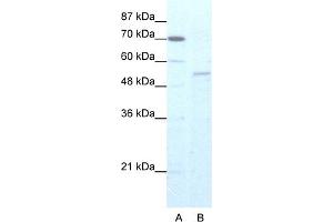 WB Suggested Anti-ZNF665 Antibody Titration:  5. (ZNF665 anticorps  (N-Term))