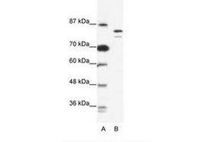 Image no. 1 for anti-Minichromosome Maintenance Deficient 8 (MCM8) (AA 144-193) antibody (ABIN203257) (MCM8 anticorps  (AA 144-193))