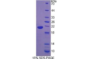 Image no. 1 for Adiponectin Receptor 2 (ADIPOR2) (AA 1-147) protein (His tag) (ABIN6236601)