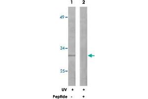 Western blot analysis of extracts from 293 cells, treated with UV (30 mins), using BCL2L1 polyclonal antibody .