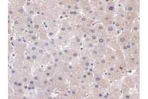 Detection of PLCB1 in Human Liver Tissue using Polyclonal Antibody to Phospholipase C Beta 1 (PLCB1)