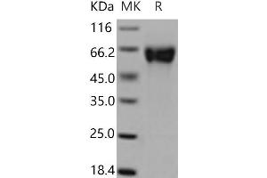 Western Blotting (WB) image for GDNF Family Receptor alpha 1 (GFRA1) (Active) protein (His tag) (ABIN7195911)