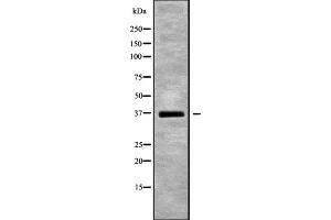 Western blot analysis of DNAJB2 using HUVEC whole cell lysates (DNAJB2 anticorps  (Internal Region))