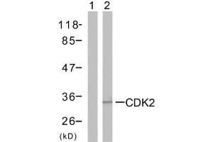Western blot analysis of the extracts from A2780 cells using CDK2 (Ab-160) antibody (E021111). (CDK2 anticorps)