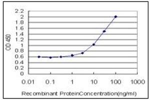 ELISA image for anti-Galactose-1-Phosphate Uridylyltransferase (GALT) antibody (ABIN781864)